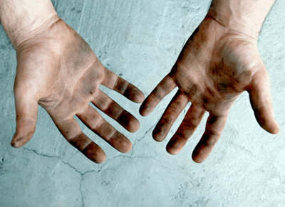 болезнь грязных рук